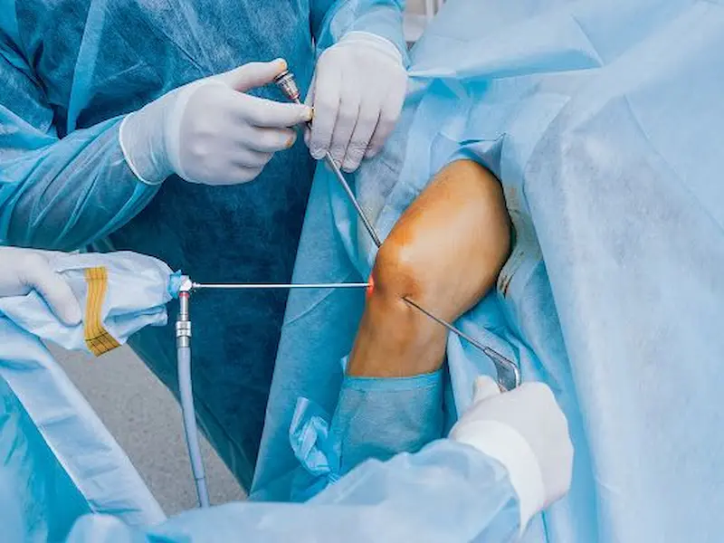 Rumah Sakit Ortopedi Terbaik di Indonesia